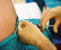 epidural-spinal-anesthesia.jpg