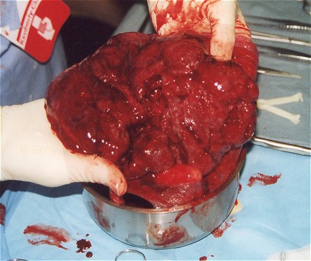 placenta-side1.jpg