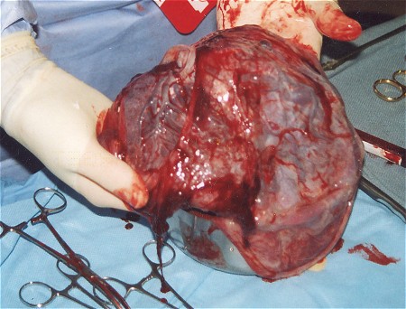 placenta-side2.jpg