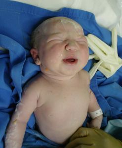 childbirth
