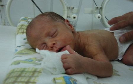 8 month premature baby